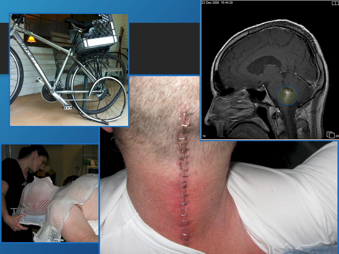 brain and spinal cancer + bike wreck
